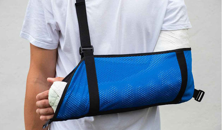 Man with a fractured arm in a cast, representing disability protection